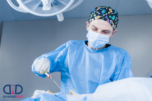انواع عمل های لاغری با جراحی معده