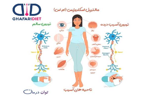 رژیم و تغذیه بیماران ام.اس