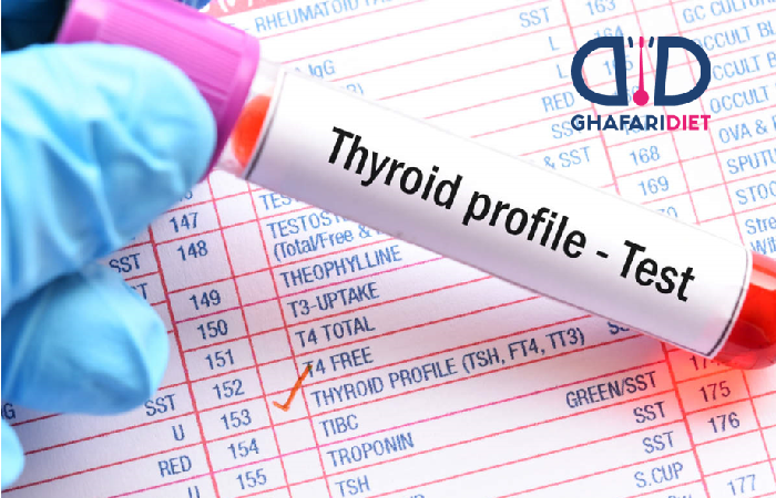 آزمایش هورمون تحریک کننده تیروئید (TSH Test)