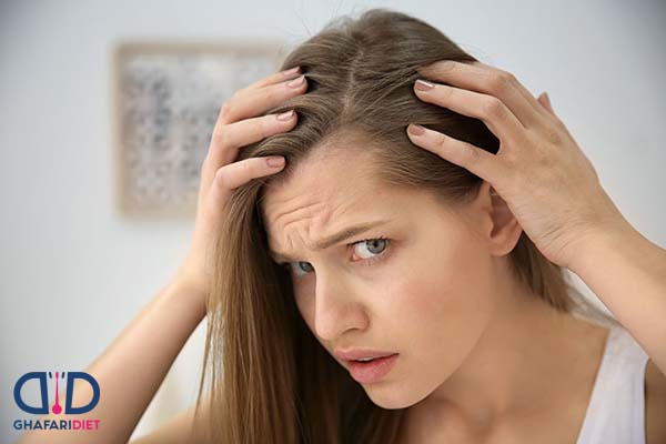 معرفی انواع آزمایش ریزش مو + ویتامین های مورد نیاز مو