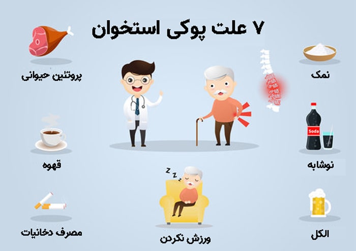 پوکی استخوان: علائم و راهکارهای درمان آن