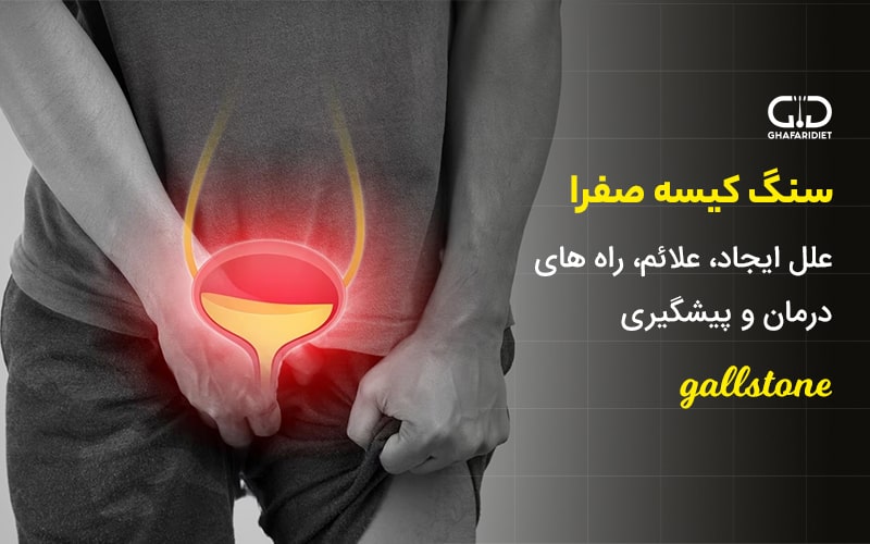 سنگ کیسه صفرا چیست؟ | علل، علائم، درمان و پیشگیری