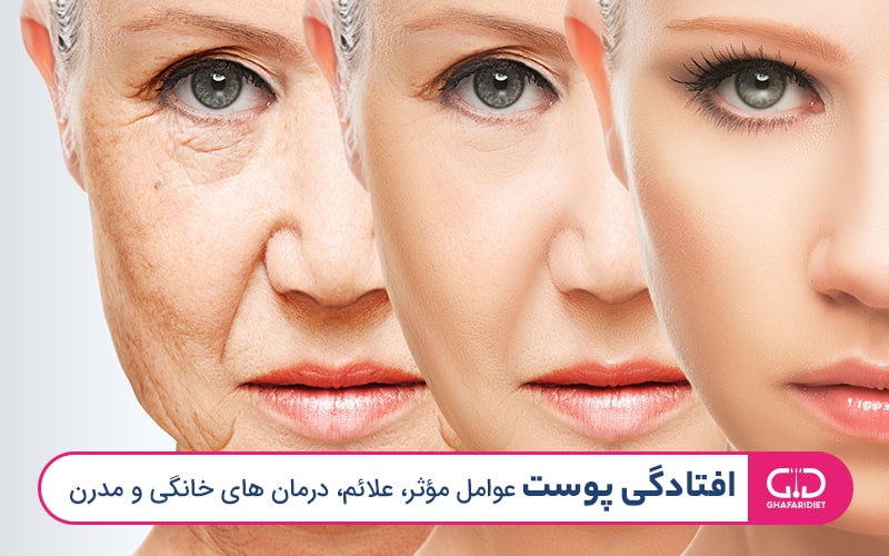 افتادگی پوست | عوامل مؤثر، علائم، درمان های خانگی و مدرن