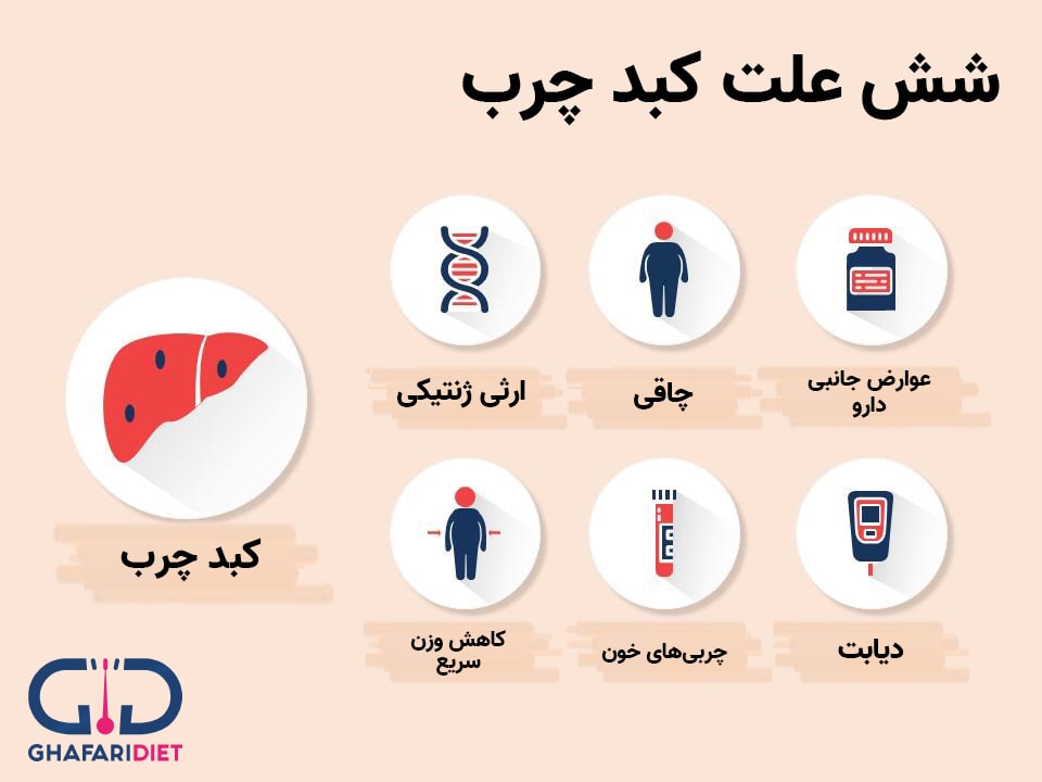 مهم‌ترین علائم کبد چرب در زنان و مردان چیست؟