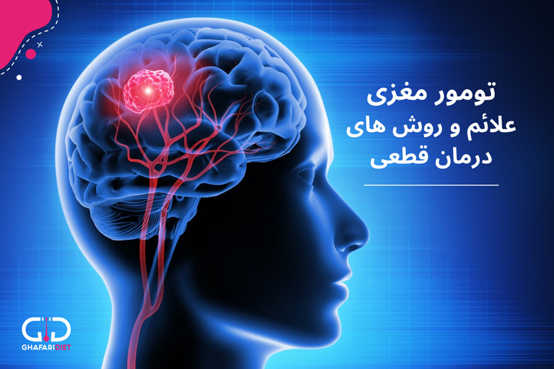 بیماری تومور مغزی، علائم و راه‌های درمان