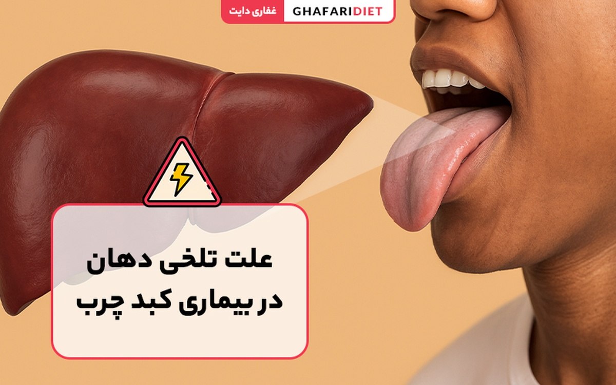 تلخی دهان نشانه مشکلات کبدی است؟ روش های درمان تلخی دهان نشانه مشکلات کبدی است؟ روش های درمان