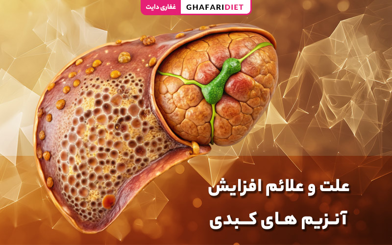 علت و علائم افزایش آنزیم‌ های کبدی (انواع + روش درمان)