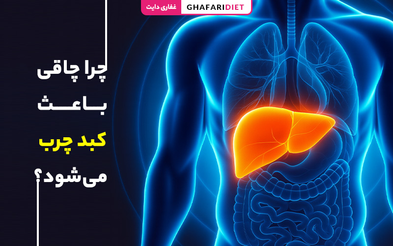 چرا چاقی باعث کبد چرب می‌شود؟ بررسی علت و عوارض