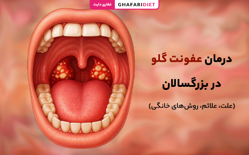 درمان عفونت گلو در بزرگسالان (علت، علائم، روش‌های خانگی)