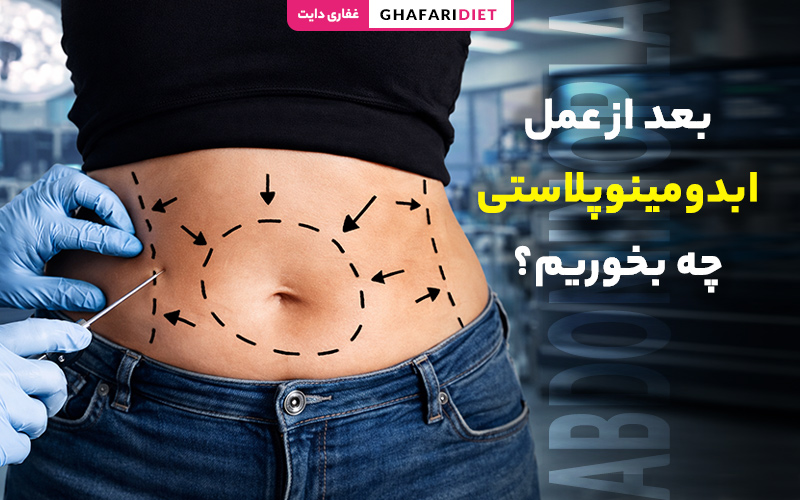بعد از عمل ابدومینوپلاستی چه بخوریم؟ (بهترین رژیم غذایی)