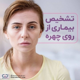 .

?رنگ رخساره خبر می دهد از سر درون! ?
.
زردی صورت و چشم ها ?
اگر متوجه رنگ زرد خفیفی در صورت و به ویژه سفیدی چشم هایتان شده اید، ممکن است دچار زردی باشید. 
سایر علائم زردی عبارتند از خستگی، سردرد، تب، کم اشتهایی، تهوع، کاهش وزن، درد شکم، خارش پوست و کم رنگی ادرار و مدفوع.
.
رنگ پریدگی پوست?
یکی از علل اصلی رنگ پریدگی پوست، کم خونی فقر آهن است. به دلیل کمبود آهن، بدن نمی تواند هموگلوبین مورد نیاز خود را که باعث به وجود آمدن رنگ قرمز خون می شود، تولید کند. 
.
خشکی و پوسته پوسته شدن لب?
این مشکل  نشانه از کمبود آب در بدن است.
در صورت کمبود آب در بدن، پوست خشک شده و لب ها ترک می خورند. همچنین کم آبی میتواند به کاهش تعریق و عدم دفع آلودگی و چربی انباشته شده بر روی پوست منجر شود که باعث افزایش احتمال ابتلا به آکنه، اگزما و پسوریازیس می گردد.
.
رنگ غیرطبیعی پوست?
زنانی که دارای سندرم تخمدان پلی کیستیک هستند ممکن است متوجه تکه های ضخیم مشکی یا قهوه ای بر روی پیشانی، گردن، ناف، زیر بغل و سینه خود شده شوند.
.
چین و چروک عمیق زودرس??
چین وچروک رابطه اجتناب ناپذیری با سن دارد، اما چین وچروک زودرس در اطراف دهان یا پیشانی می تواند در اثر قرار گرفتن بیش از حد در معرض دود سیگار ایجاد شود.
.
ترک گوشه های دهان?
ترک گوشه دهان معمولا با کمبود ویتامین ب 2 ، آهن و روی در بدن مرتبط است. کمبود ویتامین ب در بدن می تواند به التهاب غشای دهان، پوست، چشم ها و دستگاه گوارش منجر شود.
.
لکه زرد اطراف چشم ها?
بیماری های قلبی می توانند یکی از دلایل به وجود آمدن این لکه ها باشند. این لکه های زردرنگ که اغلب در نزدیکی گوشه داخلی پلک به وجود می آیند، نرم، کوچک و بدون درد هستند 
.
چشمان پف کرده?
پف و حلقه های تیره زیر چشم ممکن است به دلیل دیر خوابیدن، کمبود خواب به وجود بیایند. اما اگر با بهره مندی از خواب کافی این مشکل برایتان به وجود آمده است ممکن است نشانه ای از یک مشکل جدی پزشکی باشد. ممکن است دچار بیماری چشمی تیروئید باشید که منجر به تورم بافت ها و ماهیچه های اطراف چشم می شود.
_______________________________________
?لطفا نام و نام خانوادگی خود را به شماره 30005905 پیامک کنید تا در قرعه کشی ماهانه شرکت داده شوید.

@ghafaridiet 
______________________________________
❌لطفا بدون ذکر منبع از پست ها استفاده نشود❌
.
#گیاهی #کاهش_وزن #افزایش_وزن #رژیم_چاقی #رژیمی #رژیم_لاغری #رژیم #چاقی #لاغری #تناسب_اندام #غذای_سالم #غفاری_دایتی #غفاری_دایت #چربی #کبدچرب #کبد #قدرت#اضافه_وزن#چاق #درمان_