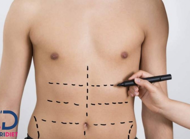 کدام بهتر است لیپوماتیک یا لیپوساکشن + مقایسه بین آن‌ ها