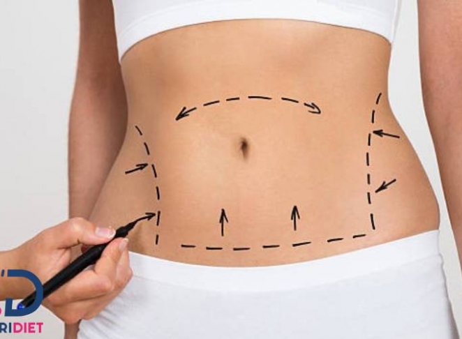 اهمیت داشتن رژیم غذایی بعد از لیپوماتیک + معرفی 5 رژیم مناسب