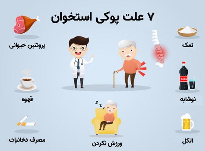 پوکی استخوان: علائم و راهکارهای درمان آن