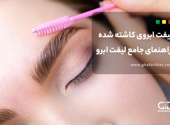 لیفت ابروی کاشته شده: راهنمای جامع لیفت ابرو بعد از کاشت ابرو