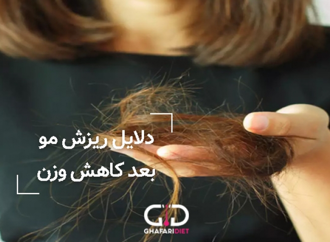 چرا بعد از کاهش وزن دچار ریزش مو می شویم؟