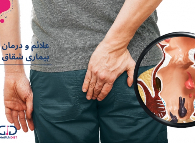 بیماری شقاق چیست؟