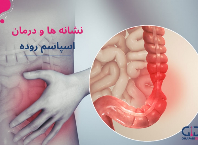 بهترین روش درمان اسپاسم روده چیست؟ 