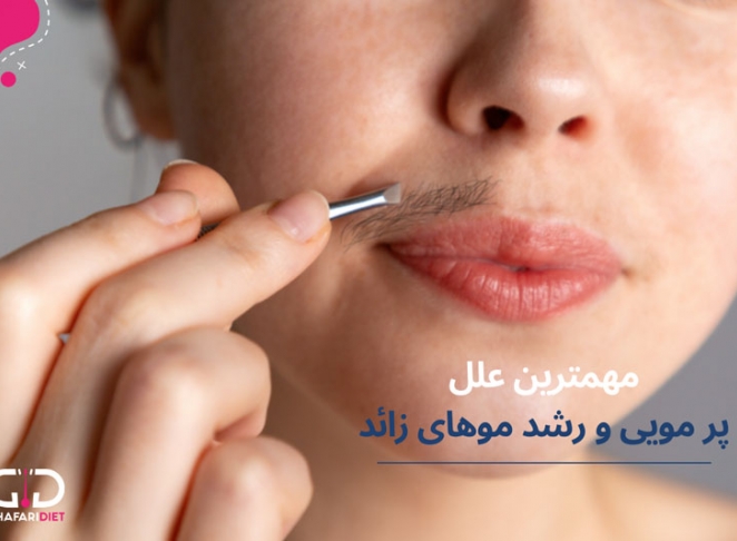 مهمترین دلایل رشد موهای زائد و پر مویی در زنان چیست؟