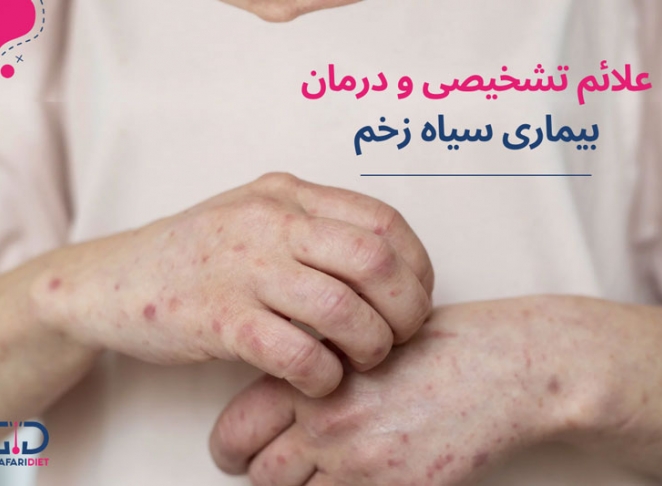 علائم بیماری سیاه زخم چیست؟ آیا درمان دارد؟