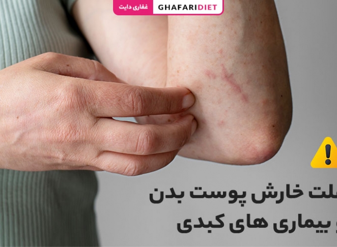 علت خارش پوست بدن و بیماری های کبدی + روش درمان
