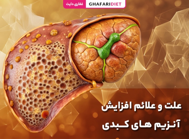 علت و علائم افزایش آنزیم‌ های کبدی (انواع + روش درمان)