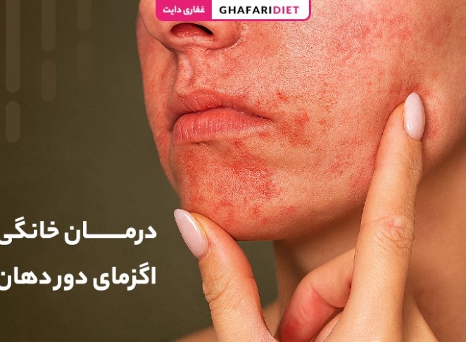 6 درمان خانگی اگزمای دور دهان + دلایل و علایم
