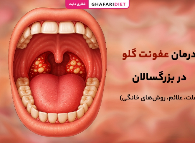 درمان عفونت گلو در بزرگسالان (علت، علائم، روش‌های خانگی)