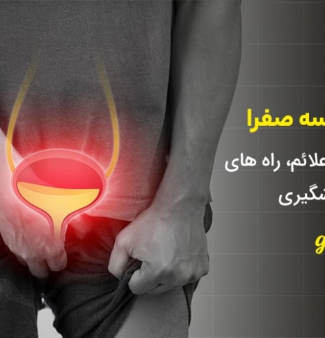 سنگ کیسه صفرا چیست؟ | علل، علائم، درمان و پیشگیری