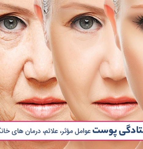 افتادگی پوست | عوامل مؤثر، علائم، درمان های خانگی و مدرن