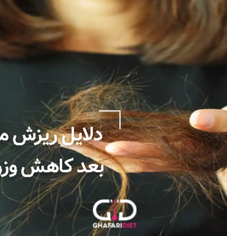 چرا بعد از کاهش وزن دچار ریزش مو می شویم؟