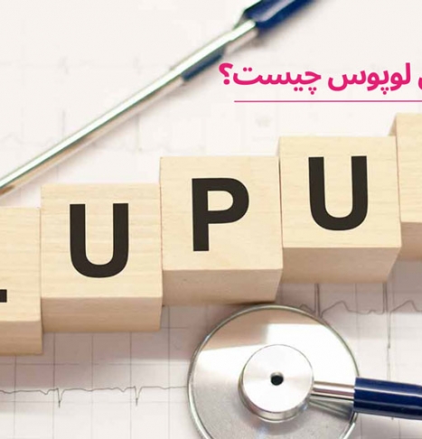 بیماری لوپوس یا SLE چیست؟ چه کسانی به آن مبتلا می شوند؟