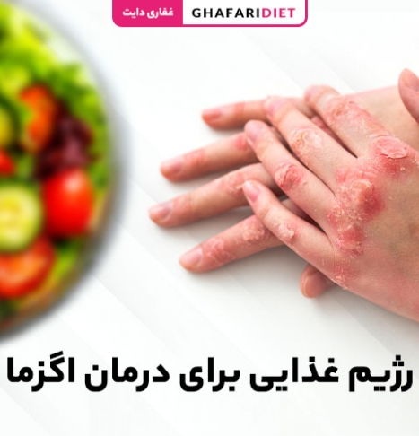 رژیم غذایی برای درمان اگزما [16 ماده غذایی ضد اگزما]