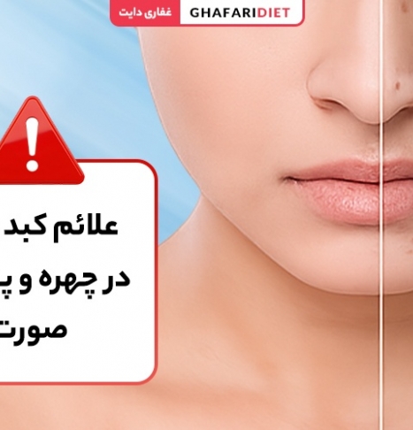 علائم کبد چرب در چهره و پوست صورت [هشدار جدی!!!]