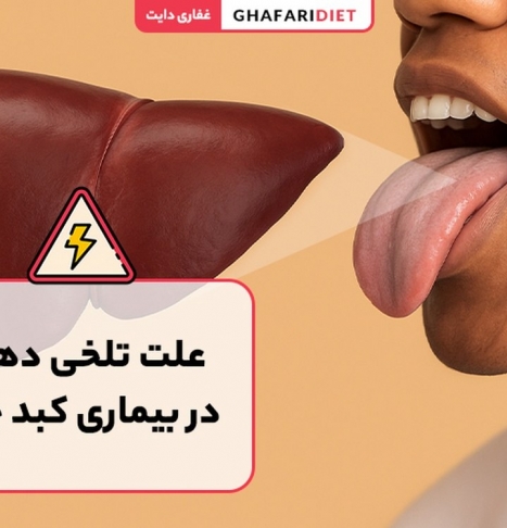 تلخی دهان نشانه مشکلات کبدی است؟ روش های درمان