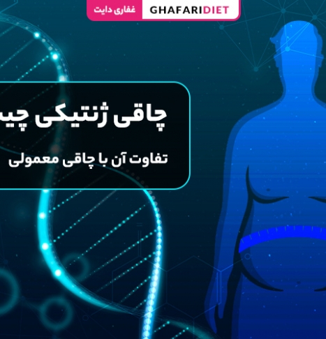 چاقی ژنتیکی (ارثی) چیست؟ تفاوت آن با چاقی معمولی