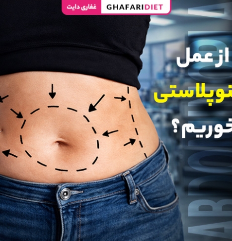 بعد از عمل ابدومینوپلاستی چه بخوریم؟ (بهترین رژیم غذایی)