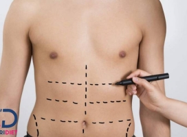 کدام بهتر است لیپوماتیک یا لیپوساکشن + مقایسه بین آن‌ ها