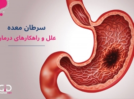 سرطان معده: علل، علائم و راهکارهای تشخیص و درمان 