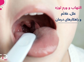 التهاب و ورم لوزه + قوی ترین آنتی بیوتیک های مناسب عفونت لوزه
