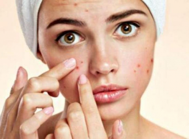 رابطه جوشِ صورت با تغذیه رابطه جوشِ صورت با تغذیه
