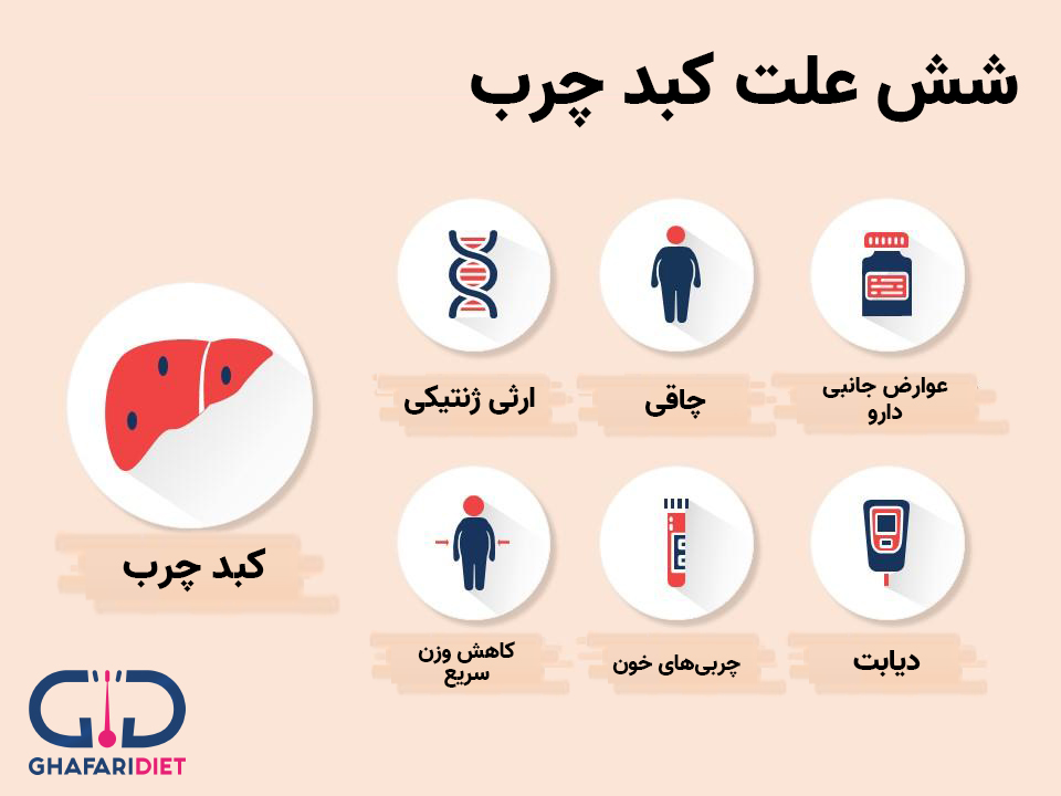 علائم کبد چرب