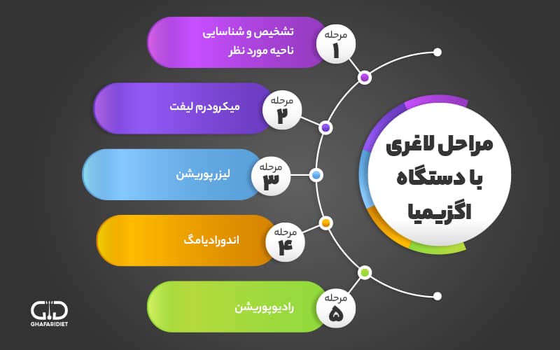 مراحل چربی زدایی با دستگاه اگزیما