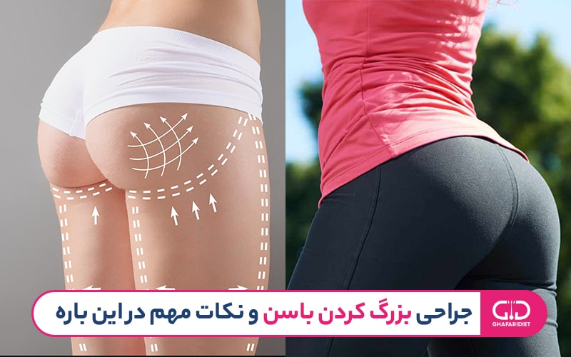 جراحی زیبایی بزرگ کردن باسن