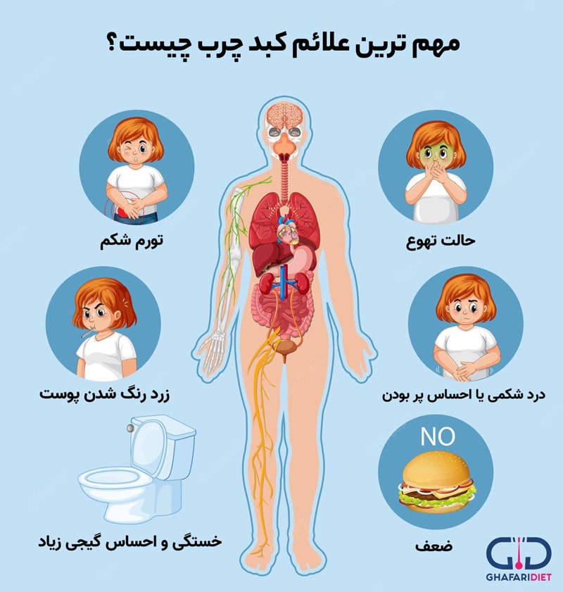 علائم کبد چرب در زنان