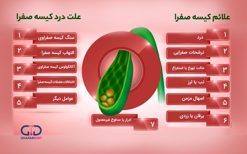 نشانه‌های بروز مشکل کیسه صفرا 