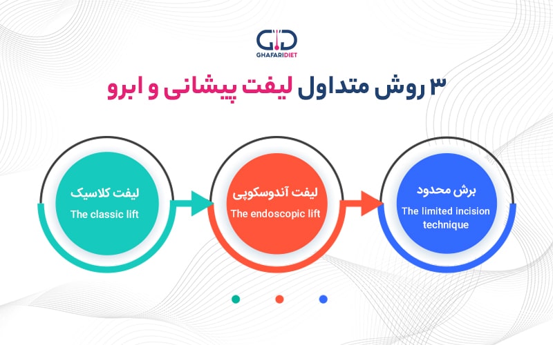 لیفت پیشانی و ابرو و انواع روش های جراحی