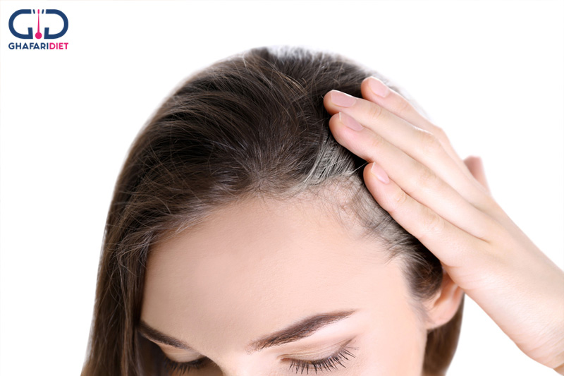 مواد غذایی که به درمان ریزش مو کمک می کنند