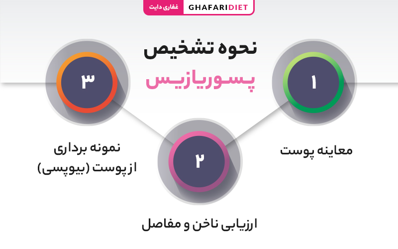 نحوه تشخیص بیماری پوستی پسوریازیس
