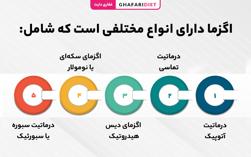 انواع مختلف بیماری اگزما